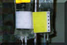 These are the bottles of Depsipeptide that will be distributed into my body.